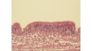 Histology image of tracheal lining