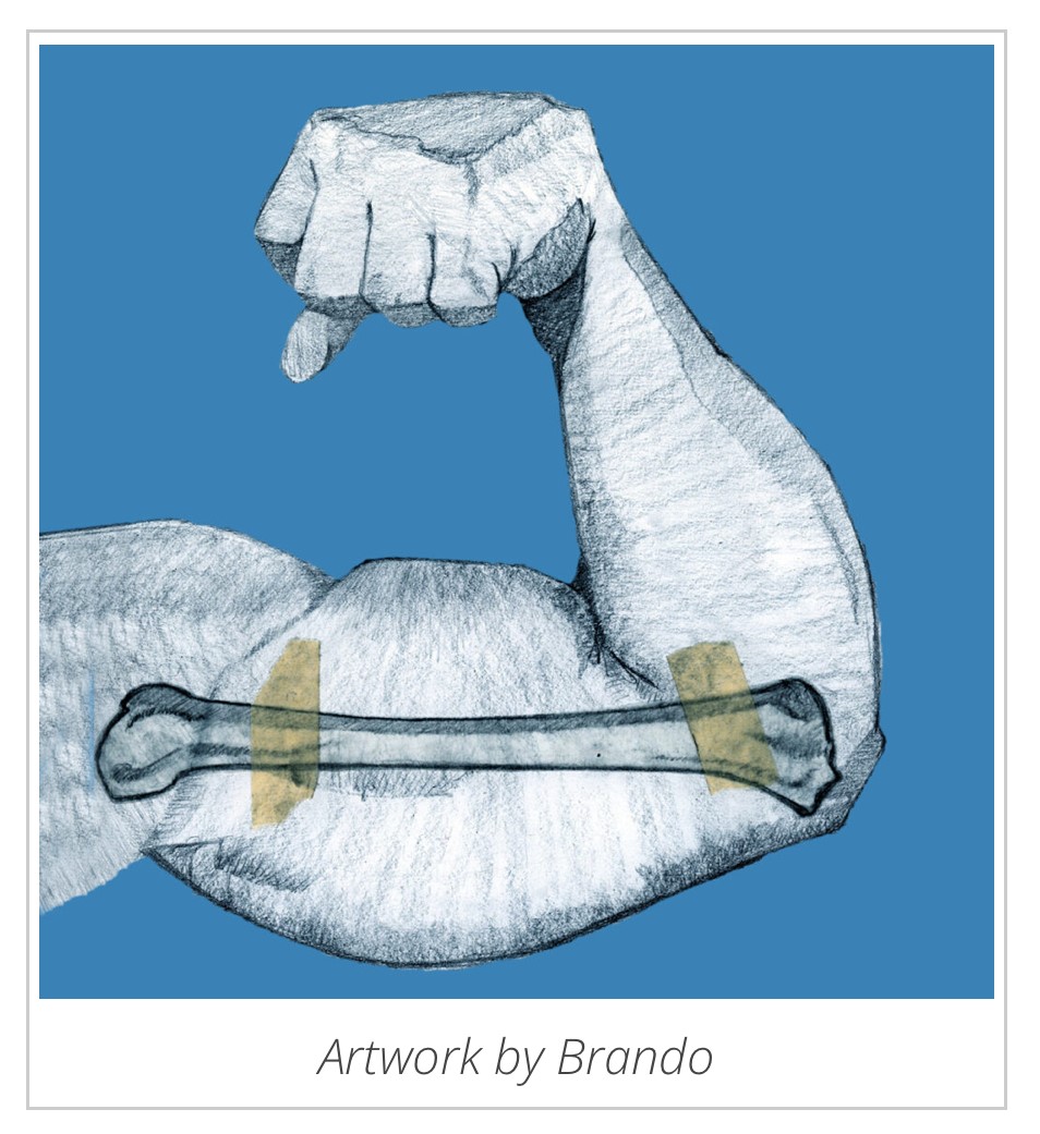 An illustration of a pencil drawn arm, from shoulder to hand, flexes its muscles on a sky blue background. A pencil drawn bone is attached to the bicep with masking tape. Text below the drawing "Artwork by Brando" This image is part of the exhibit curated by Erica Hughes.